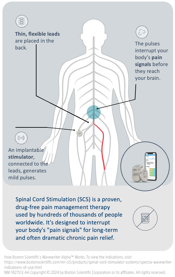 SCS How It Works Image_NM-1827512-AA