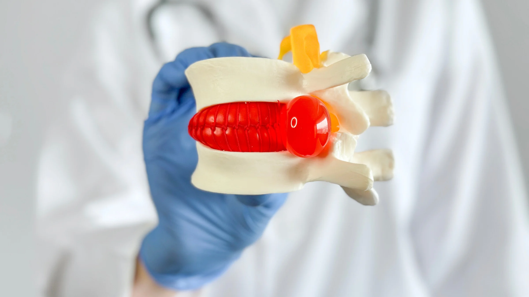 herniated disc and bulging disc